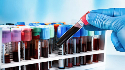 BioStem: созданной бывшими автогонщиками медицинской компании предсказали трехкратный рост